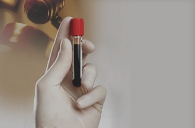 Photo of Caribbean countries concerned over new strain of HIV/AIDS virus