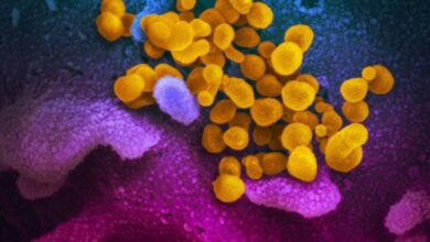 Photo of CARPHA Statement on the Brazil Variant (P.1)