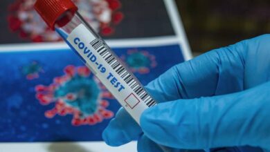 Photo of CARPHA Laboratory Achieves 100% Turnaround Time For All Diagnostic Tests