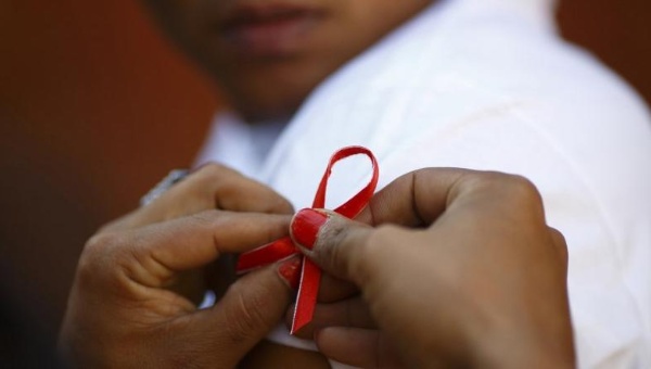 Photo of Cuba Leading Eradication of HIV/AIDS, UN Says