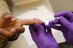 Photo of MINISTRY OF HEALTH ON VERGE OF RAPID HIV TESTING