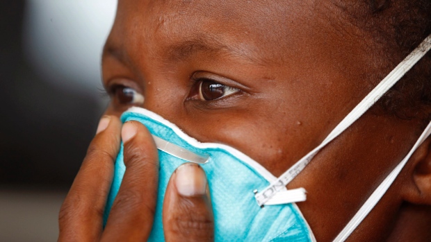 Photo of Tubercolosis (TB) is still a Health Threat In The Caribbean